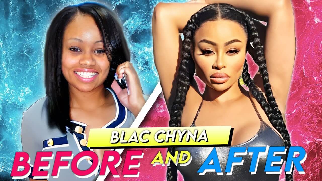Blac Chyna Before and After