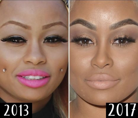 Blac Chyna Plastic Surgery Real? Photos Before and After Operations ...