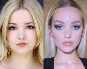 Dove Cameron Plastic Surgery: Before & After Photos ...