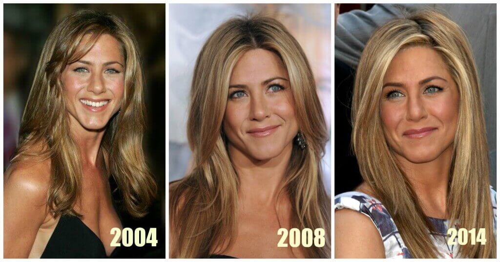 Jennifer Aniston Plastic Surgery Before & After Photos