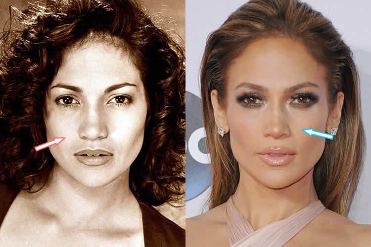 Jennifer Lopez Nose