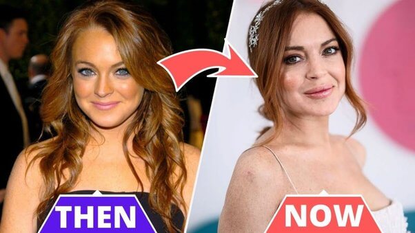 Lindsay Lohan Before and After