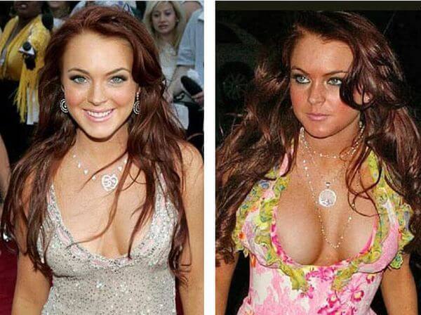 Lindsay Lohan Breast