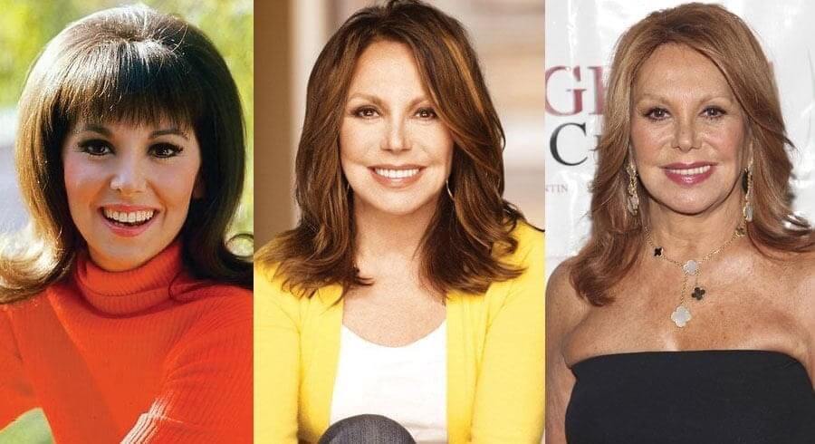 Marlo Thomas Before and After