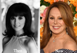 Marlo Thomas Plastic Surgery: Before & After Transformations ...