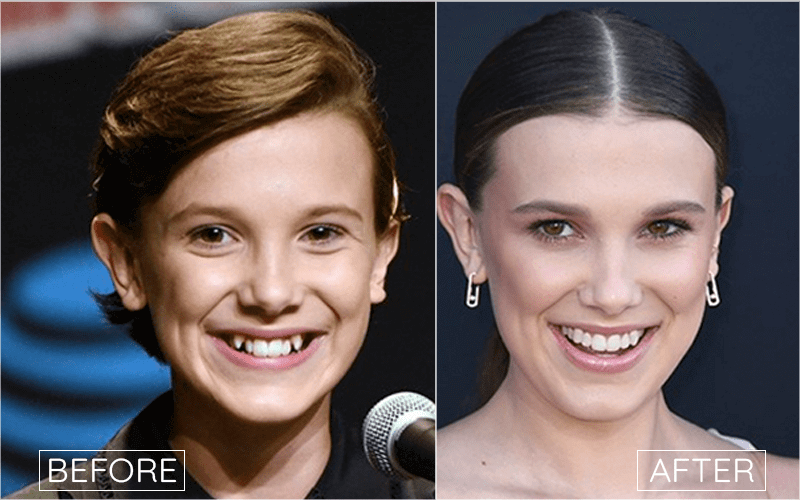 Millie Bobby Brown Nose