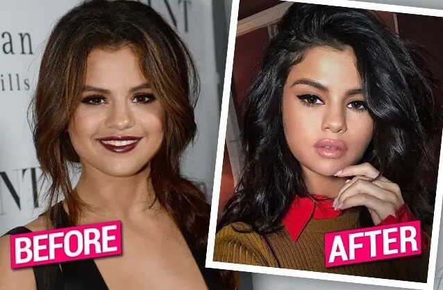 Selena Gomez Before and After