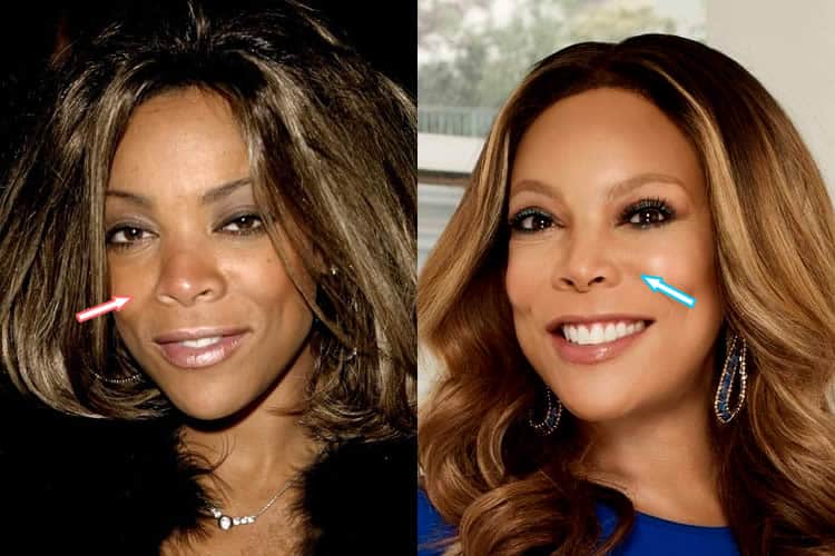 Wendy Williams Nose