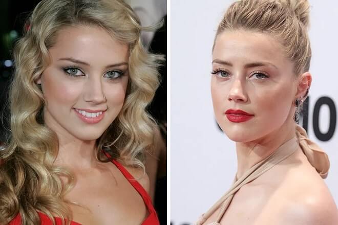Amber Heard Before and After