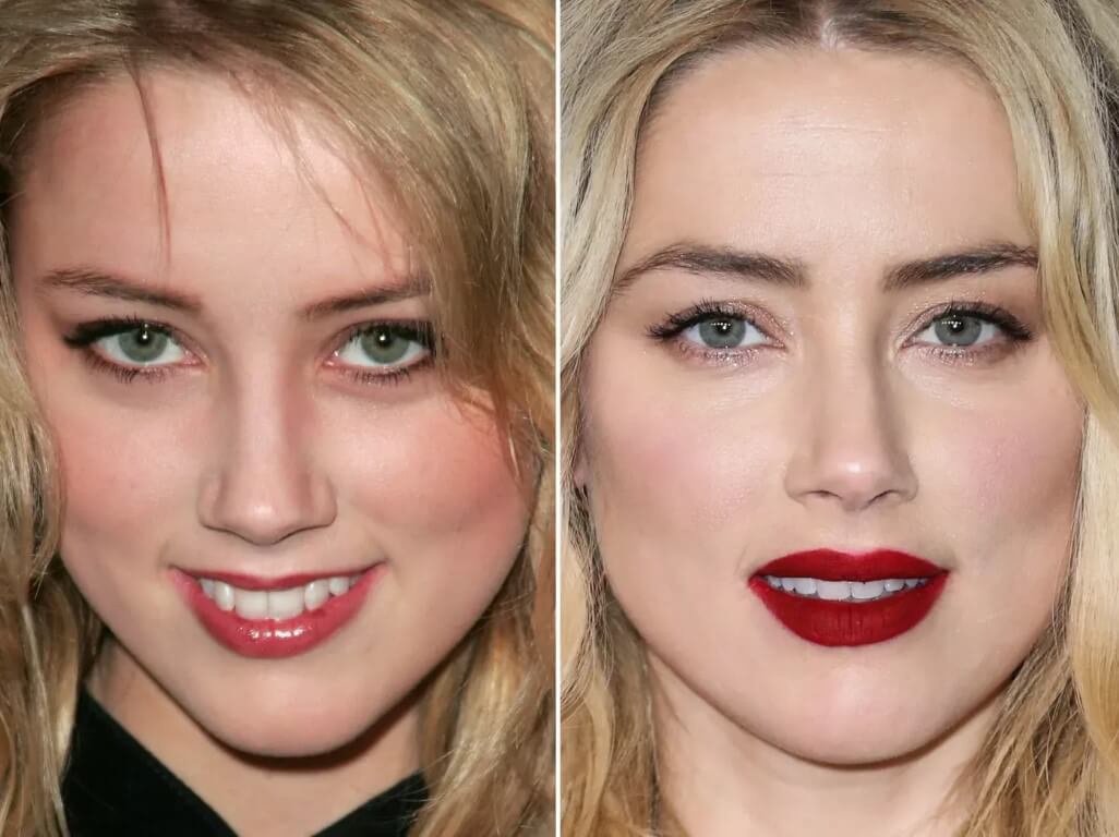 Amber Heard Lips