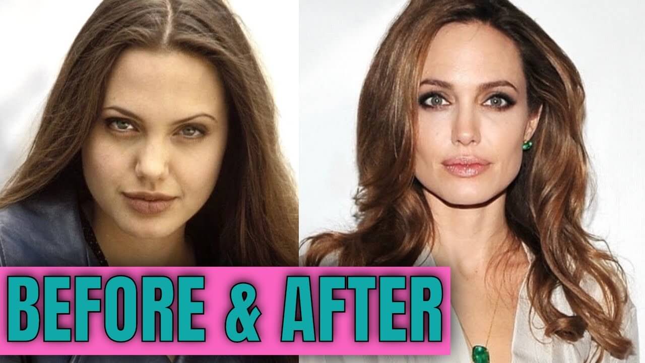Angelina Jolie Before and After