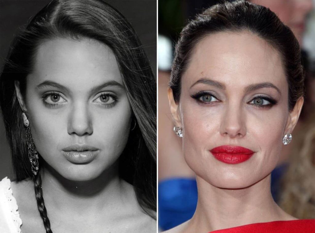 Angelina Jolie Plastic Surgery: Transformation Photo ...