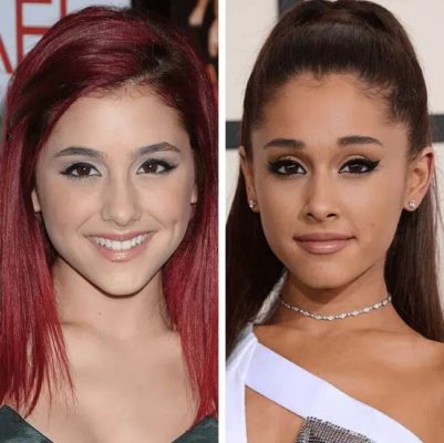 Ariana Grande Plastic Surgery: Facts, Rumors, and Transformations ...