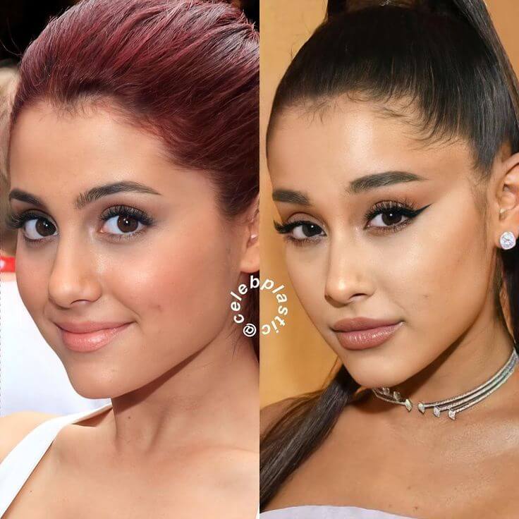 Ariana Grande Eyebrow Lift