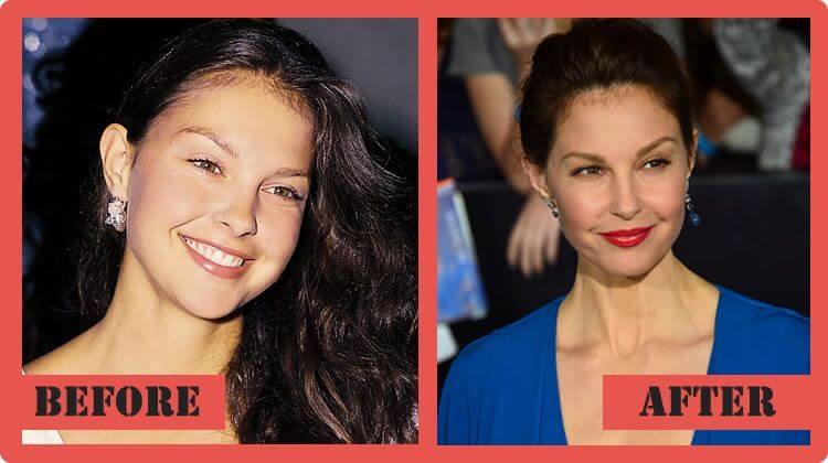 Ashley Judd Before and After