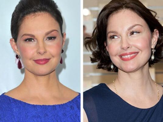 Ashley Judd Facelift