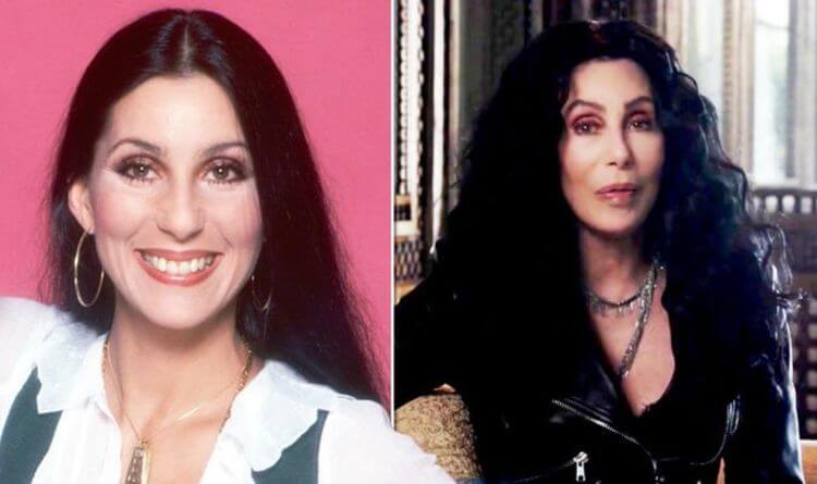Cher Eyelid Surgery