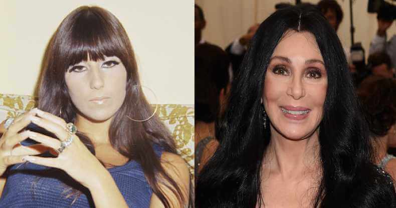 Cher Facelift