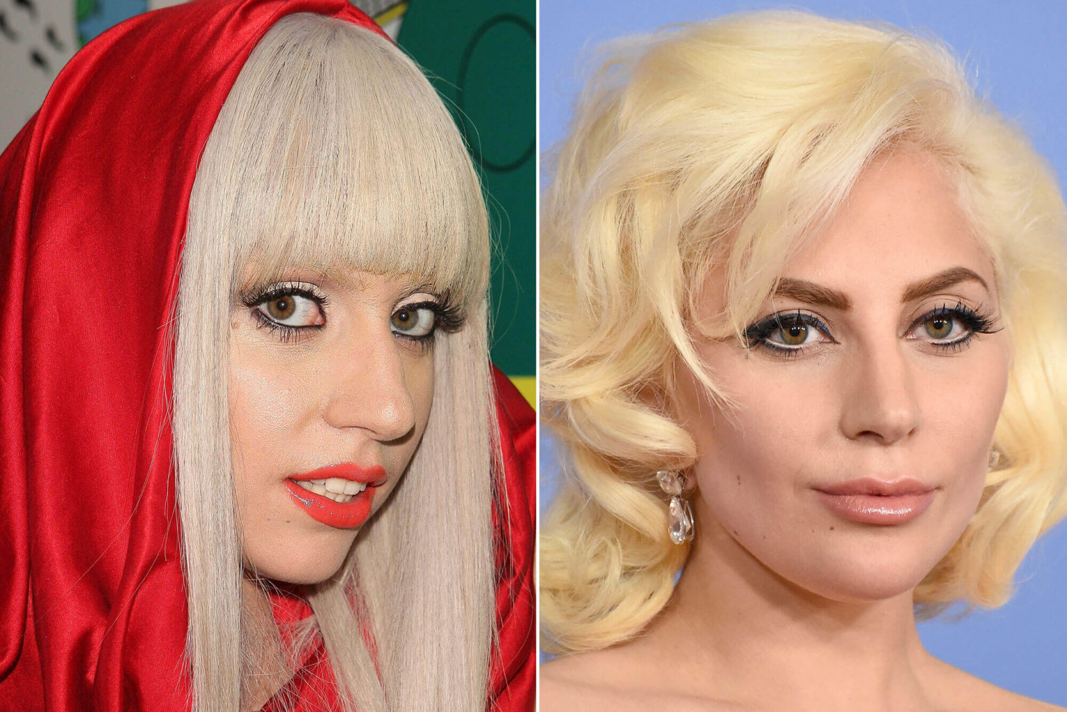 Lady Gaga Plastic Surgery Facts, Rumors, and Expert Opinions