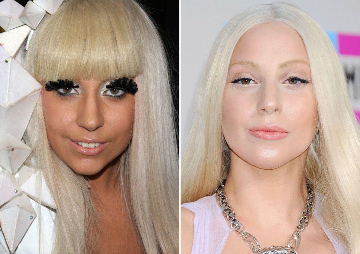 Lady Gaga Before and After Analysis