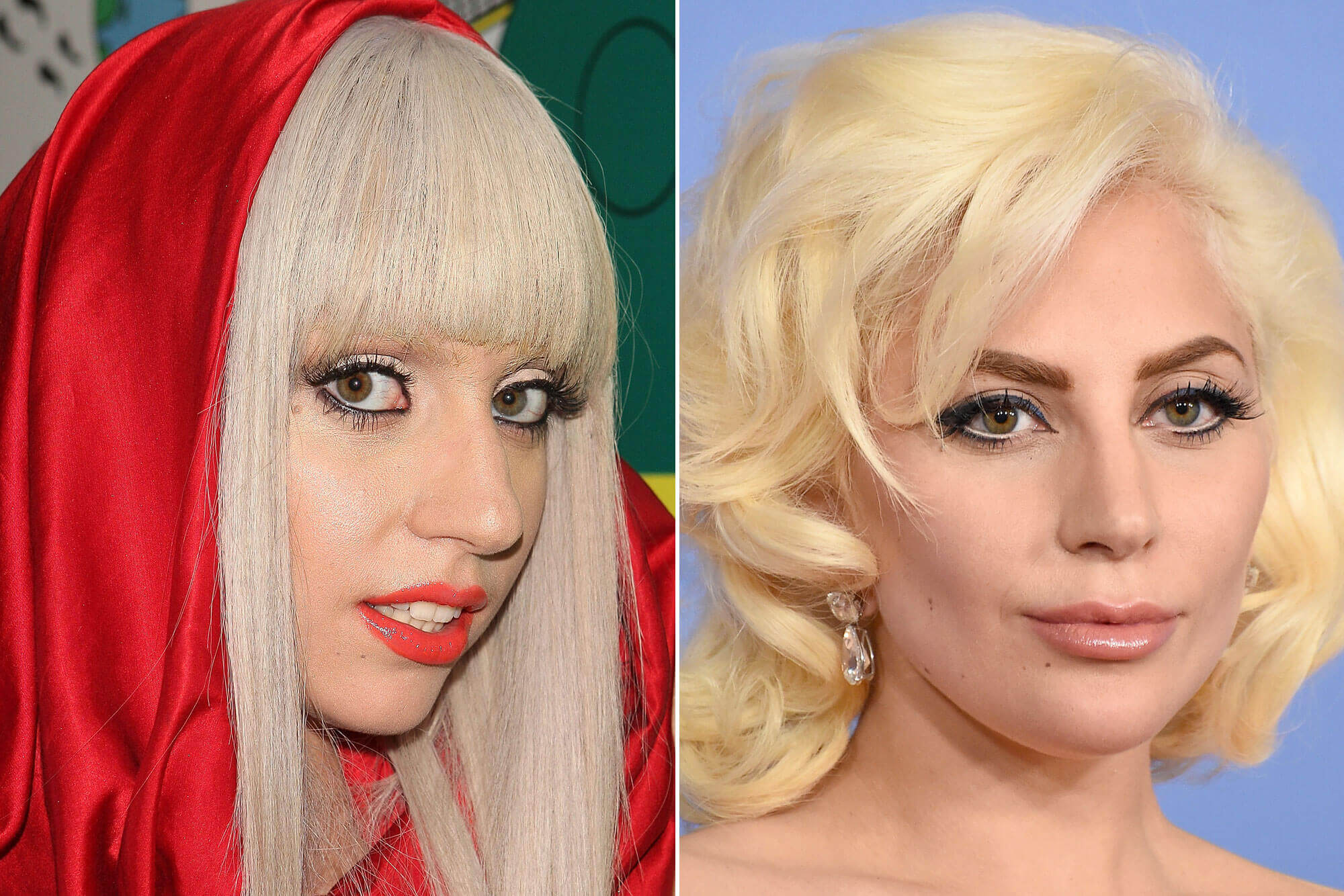 Lady Gaga Before and After