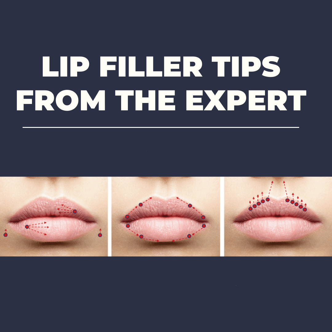 Lip Filler Tips