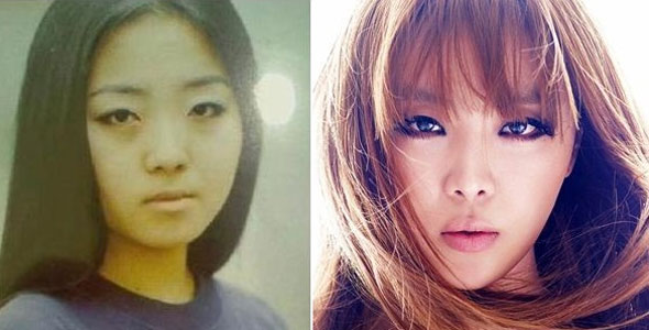 Narsha Before and After