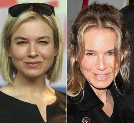 Renee Zellweger Plastic Surgery: Before and After Photos ...