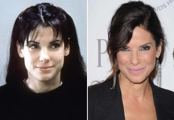 Sandra Bullock Plastic Surgery: Rumors, Before and After ...