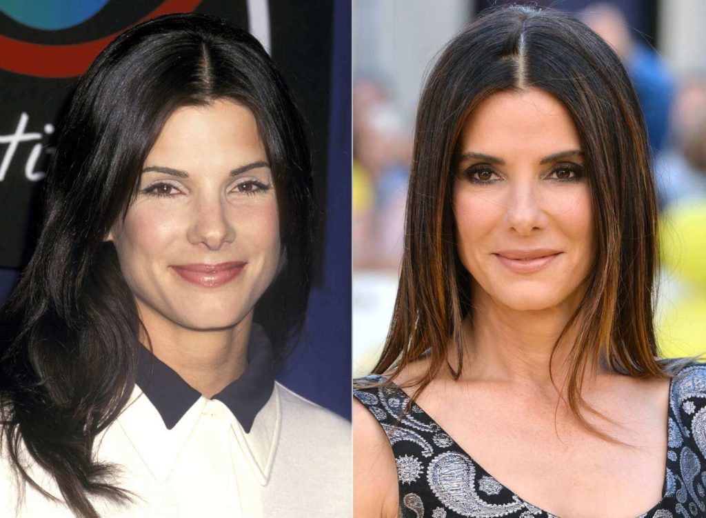 Sandra Bullock Plastic Surgery: Rumors, Before and After ...