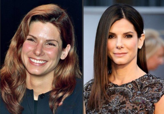 Sandra Bullock Plastic Surgery: Rumors, Before and After ...