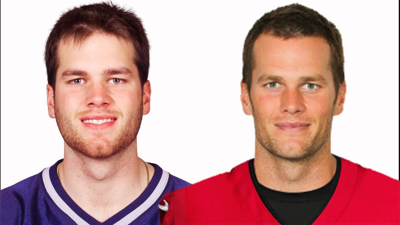 Tom Brady Before and After Analysis