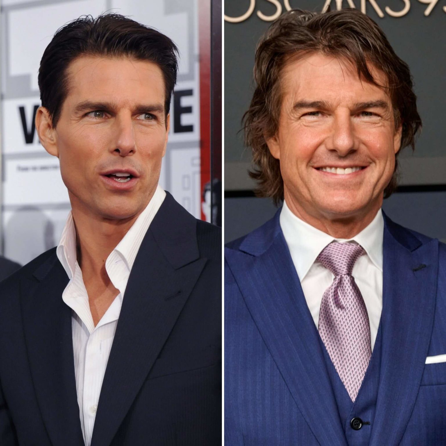 Tom Cruise Plastic Surgery: Before and After Photos ...