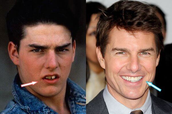 Tom Cruise Lips