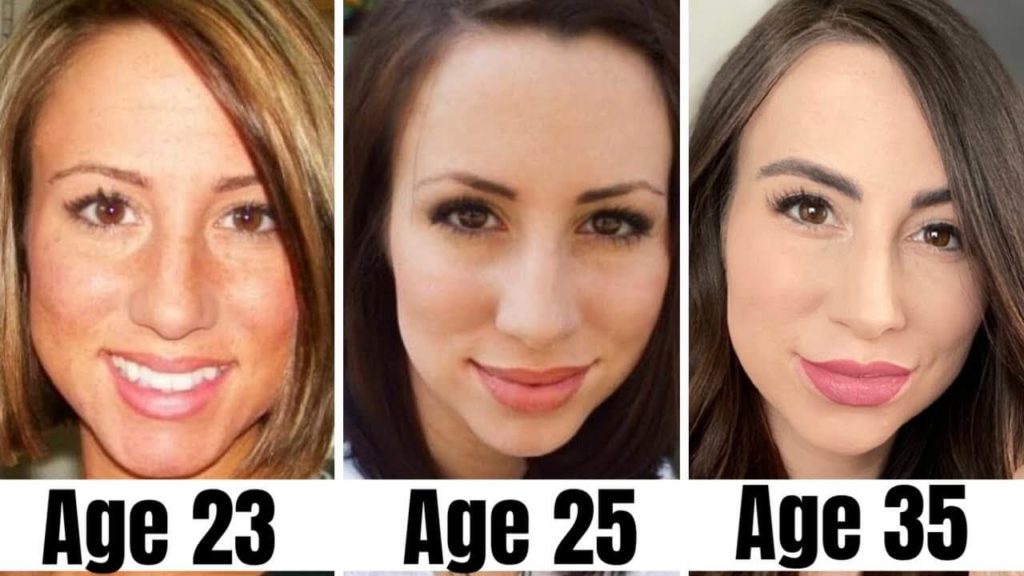 Tretinoin Before and After Photos: What You Need to Know