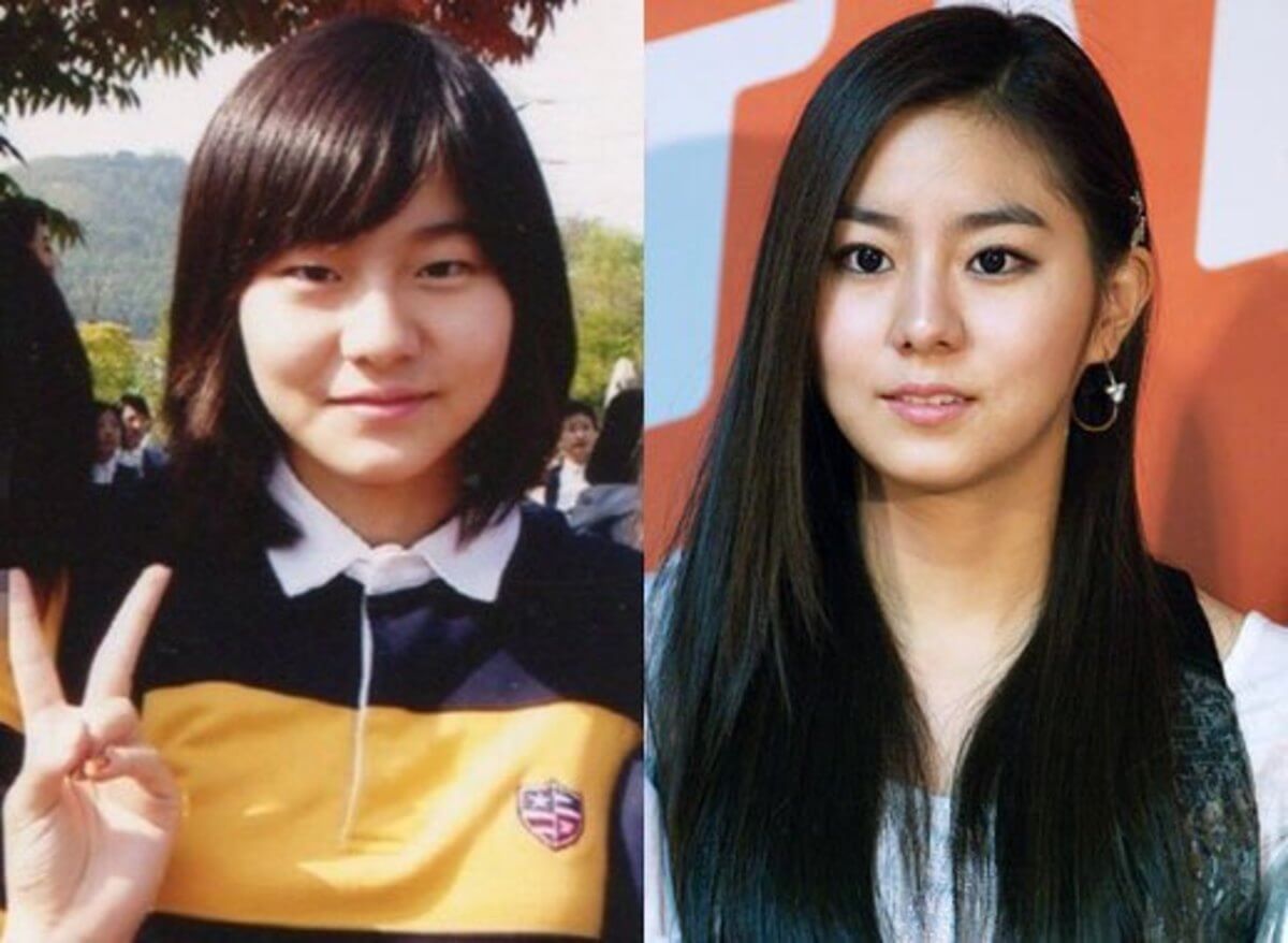 Uee Before and After