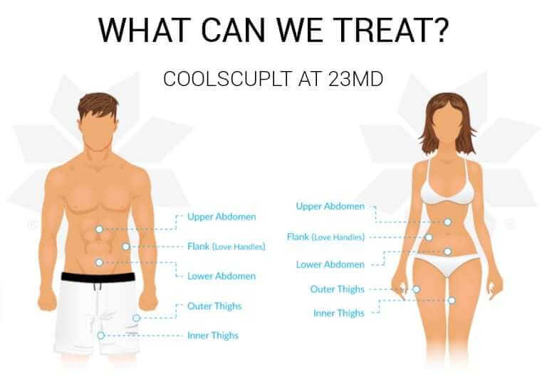 What Can We Treat Coolsculpting?