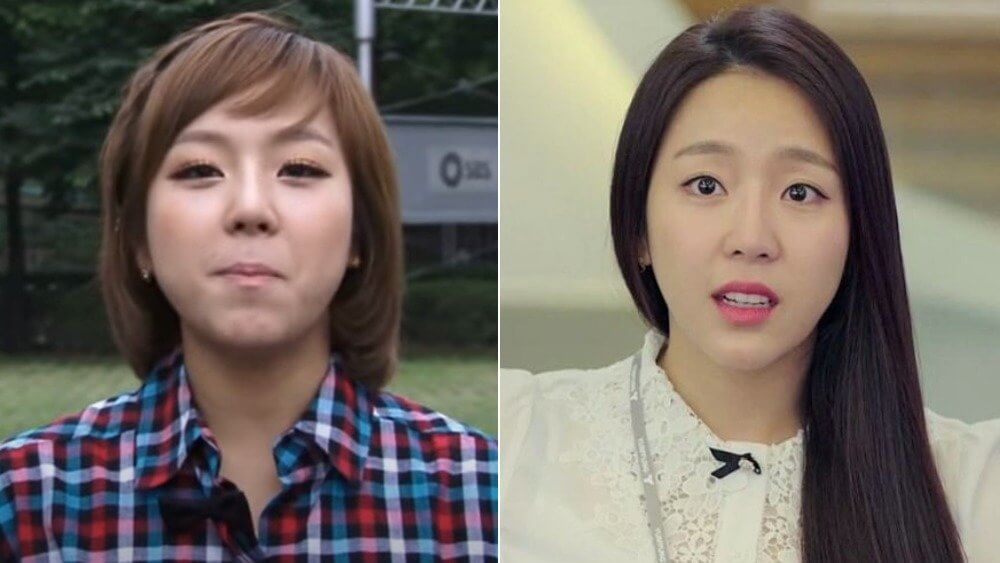 Yewon Before and After