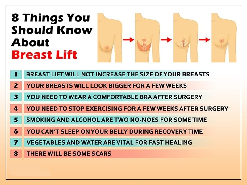 8 Things You Should Know About Breast Lift
