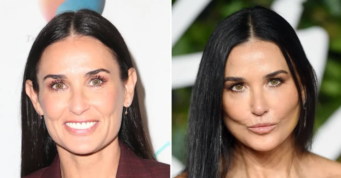 Demi Moore Before and After