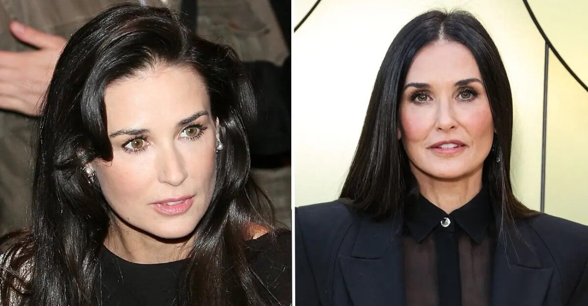 Demi Moore Plastic Surgery: An In-depth Analysis ...