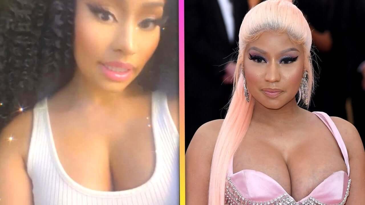 Nicki Minaj Breast Reduction Before and After