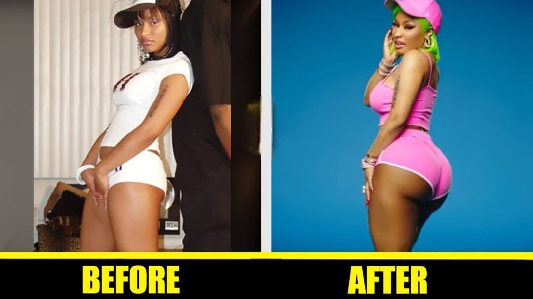 Nicki Minaj Butt Before and After