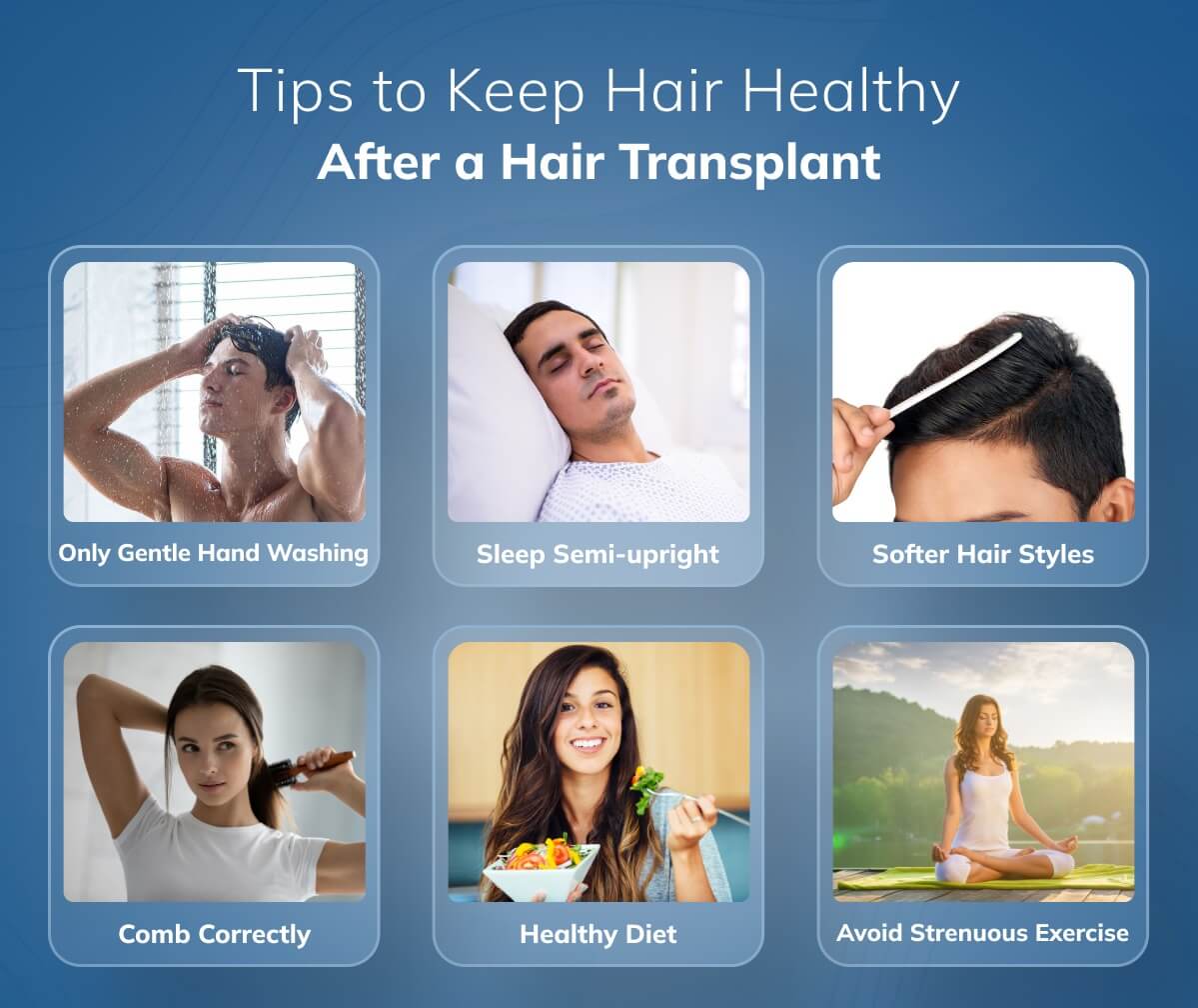 Tips After Hair Transplant