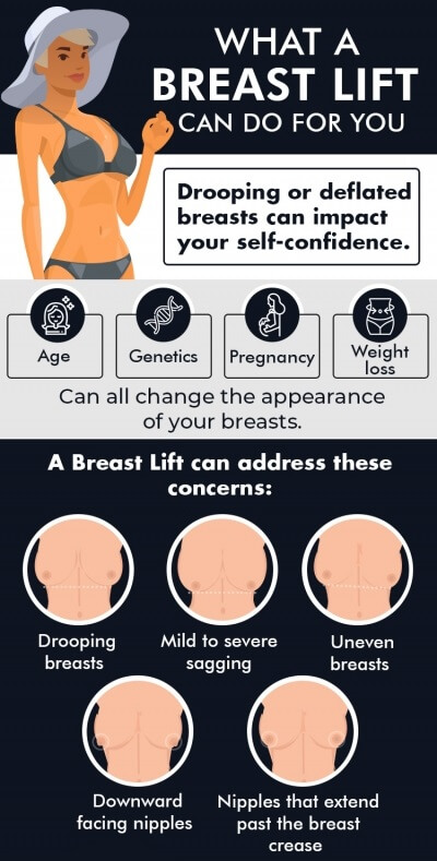 What a Breast Lift?