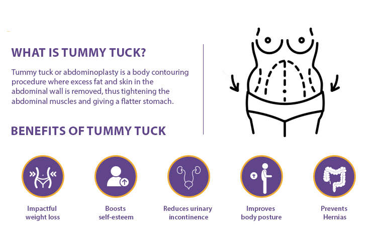 Benefits Of Tummy Tuck