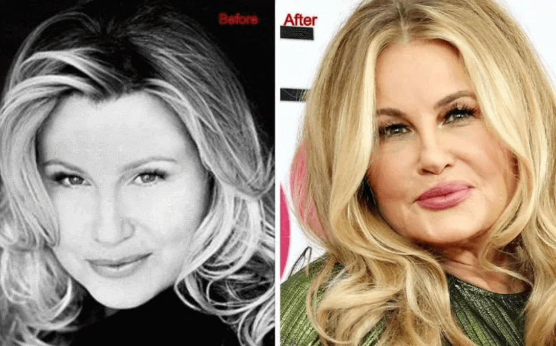 Jennifer Coolidge Before and After