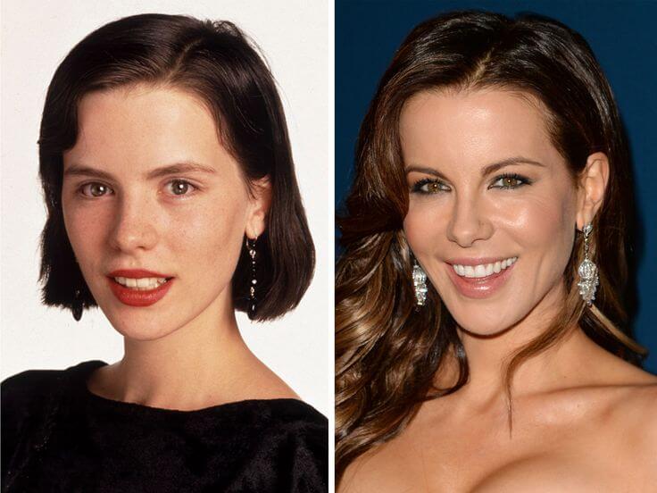 Kate Beckinsale Before and After