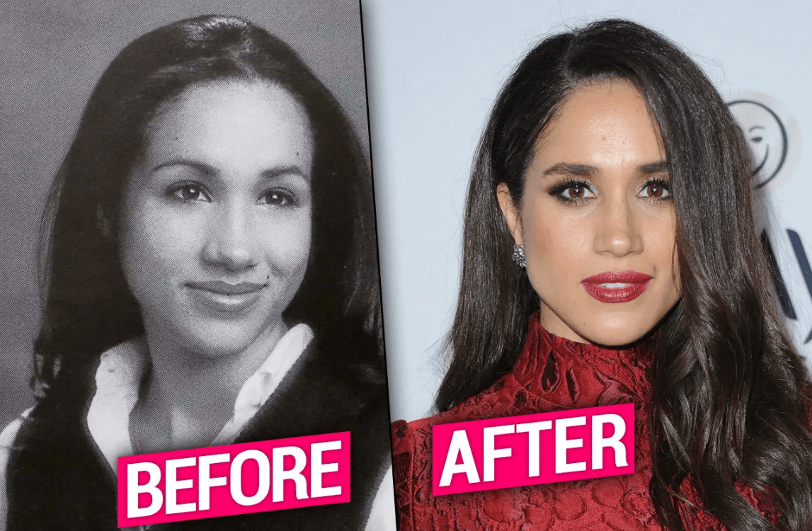 Meghan Markle Before and After