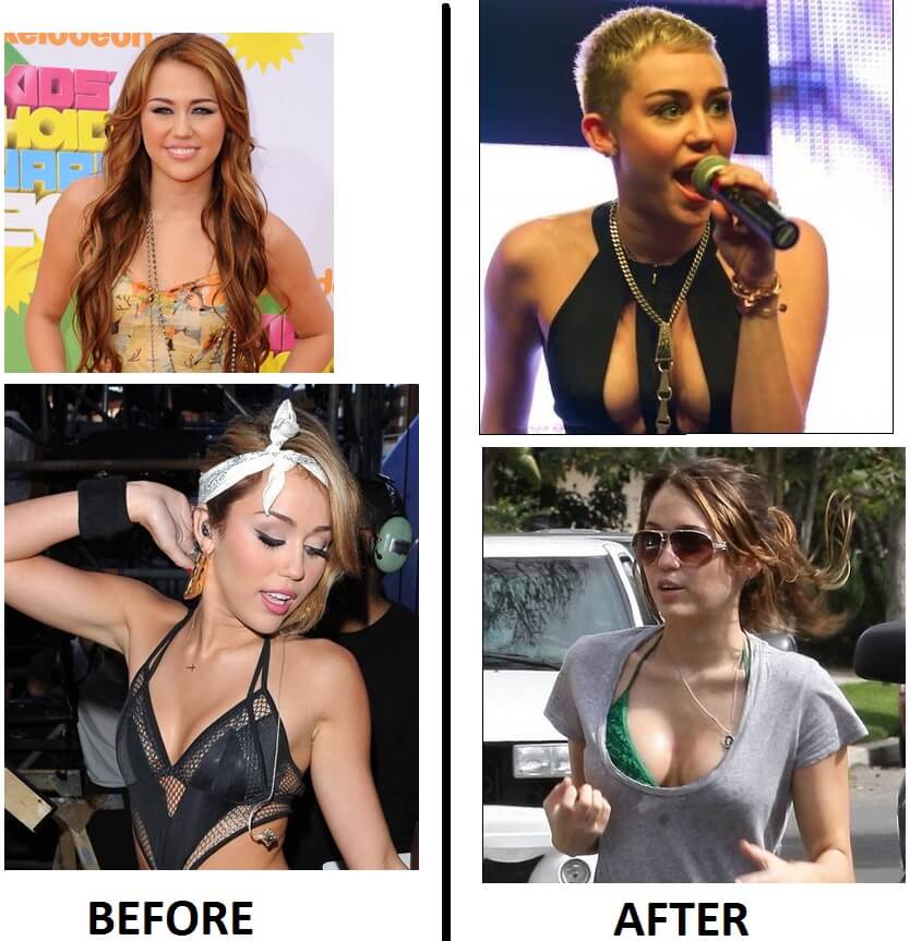 Miley Cyrus Breast Augmentation